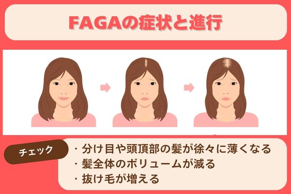 FAGAの症状と進行