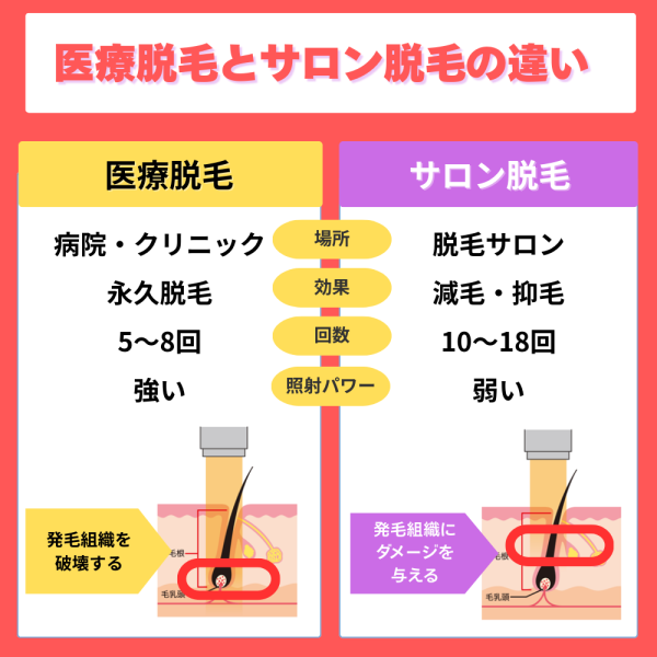 医療脱毛とサロン脱毛の違い