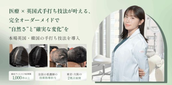 英国式頭皮アートメイク