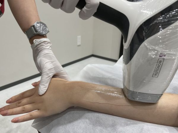 フレイアクリニック施術風景