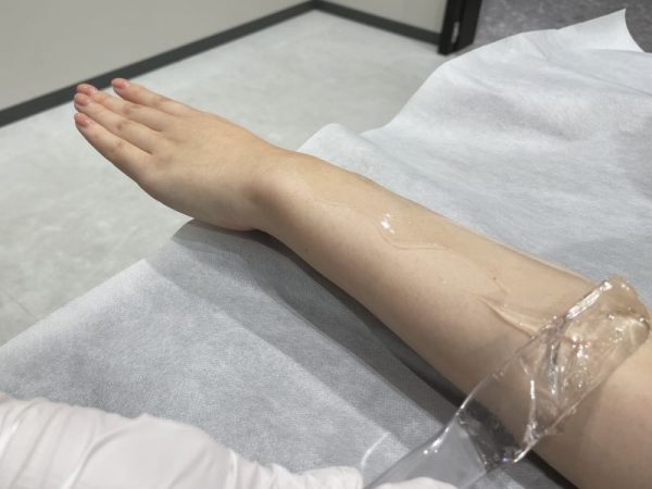 フレイアクリニック施術風景